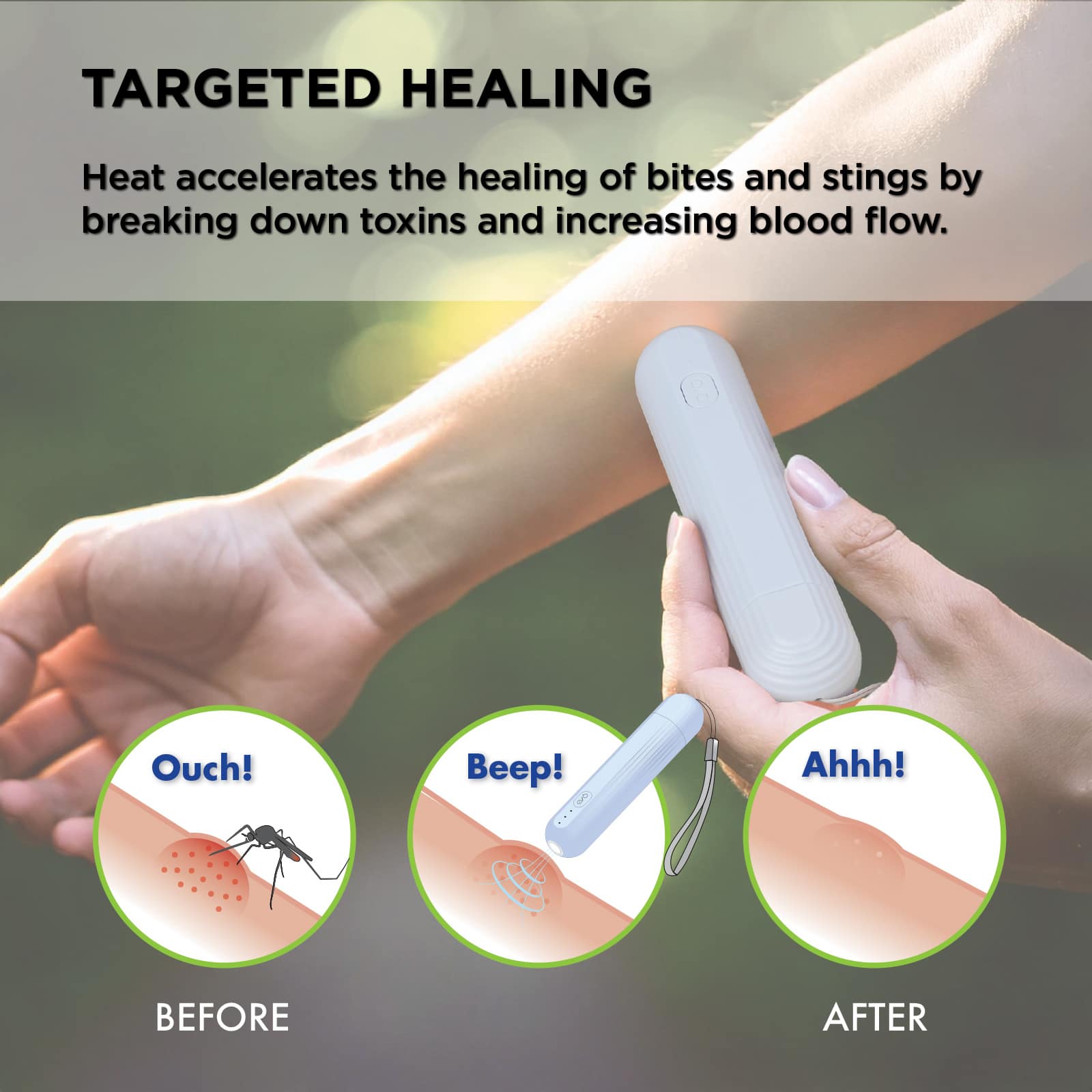 HealthWise Insect Bite and Sting Helper - Image 2